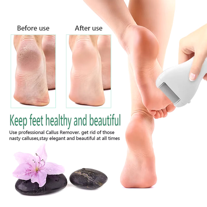 USB Rechargeable Electric Foot File