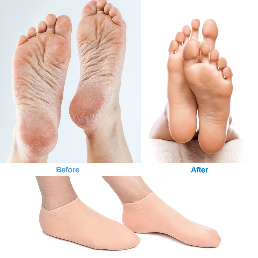 Silicone Gel Moisturizing Socks