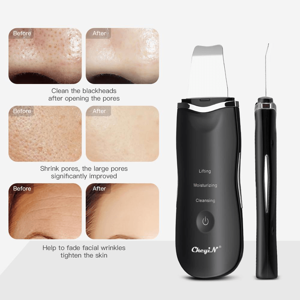 Ultrasonic Ion Deep Cleaning Skin Scrubber Peeling Shovel Facial Pore Cleaner Blackhead Remover Face Lifting USB Rechargeable Beauty Machine - Trendha
